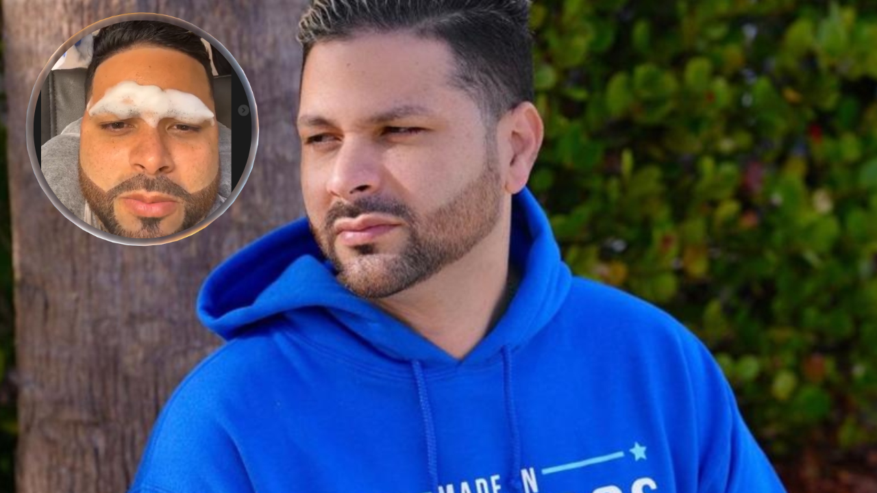 Imagen de Jorge Cordero sorprende a seguidores al realizarse el microblading  y otros arreglitos, mira cómo luce