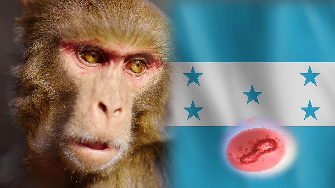 Imagen Principal de Nota: Salud confirma el primer caso de viruela del mono en Honduras