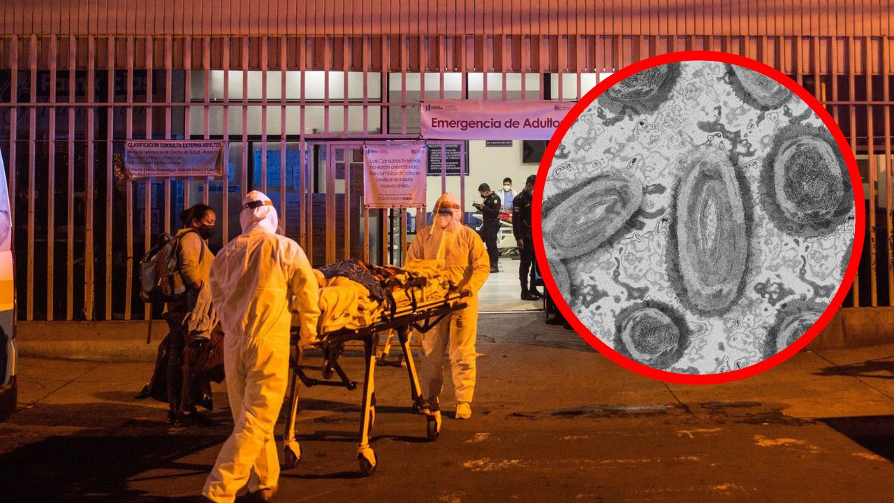 Imagen Principal de Nota: ¿Por qué los fallecidos por viruela del mono deben ser cremados? Médico hondureño explica