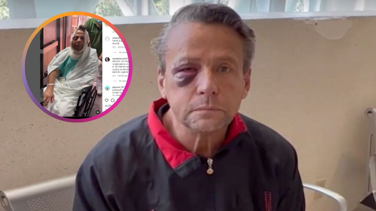 Imagen de Impactantes imágenes de Alfredo Aldame al salir del hospital tras ser operado de emergencia