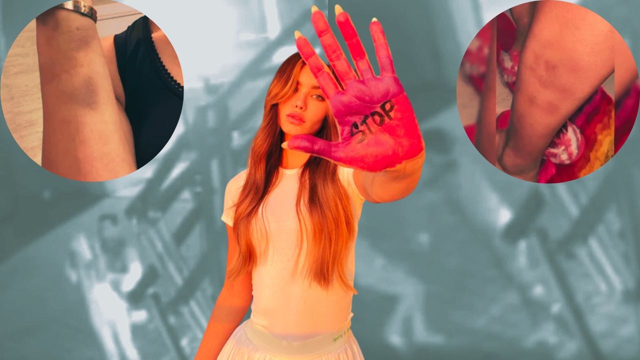 Imagen de Aleska Génesis muestra el infierno que vivió junto a su ex ¿Nicky Jam?
