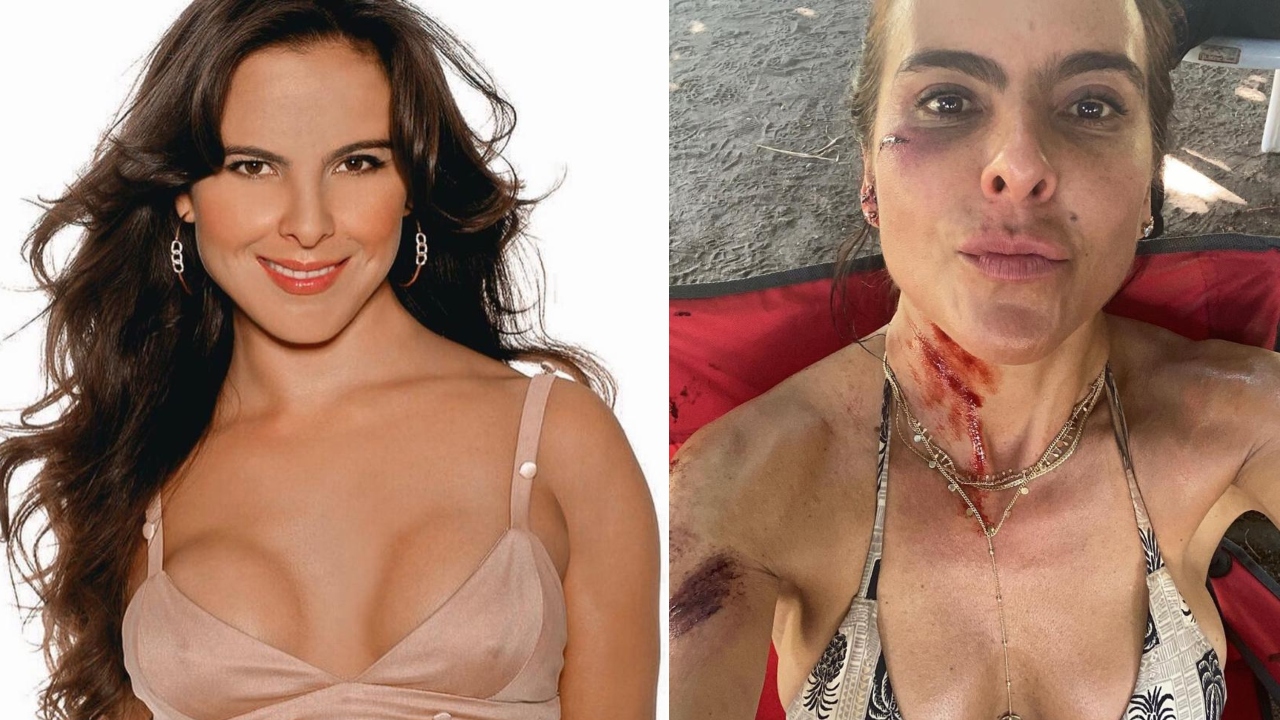 Imagen de 'No me reconocí': Kate del Castillo habla del abuso doméstico que vivió con su expareja