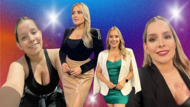 Imagen Principal de Nota: 'Yo no tengo la culpa de haber nacido así', Tanya Rodríguez tras sufrir criticas por su lunar