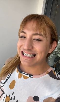 Otro retoque estético se hizo La Bicha Catracha, pero en su dentadura y promete que al final su proceso dará su mejor sonrisa a sus seguidores
