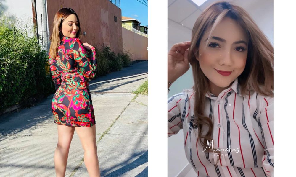 Imagen Principal de Nota: 'Vamos por la segunda lipo': Carla Cubas podría realizarse  nuevo 'retoque estético'