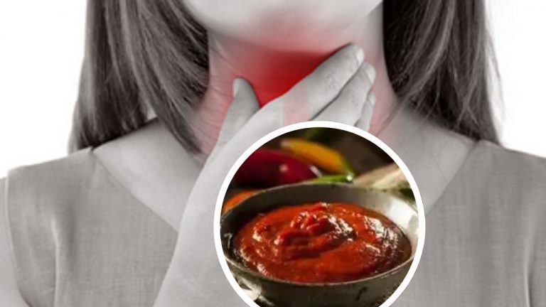 Imagen Principal de Nota: Estos son los 5 alimentos que debes evitar si tienes dolor de garganta según experto