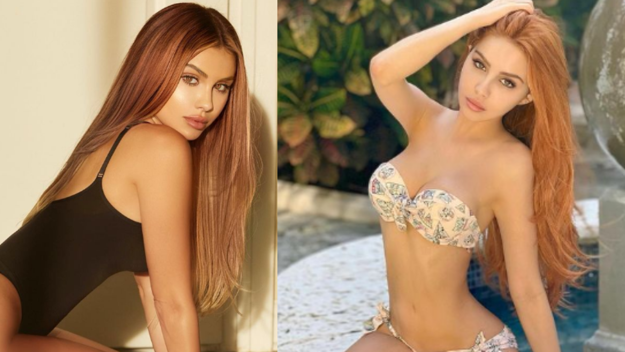 Imagen Principal de Nota: Alexa Dellanos se somete a nueva cirugía estética y muestra sus resultados