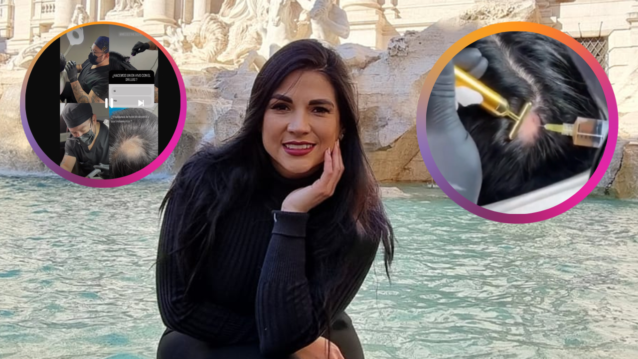 Imagen Principal de Nota: Con impactante vídeo, Stefany Galeano revela que tiene alopecia
