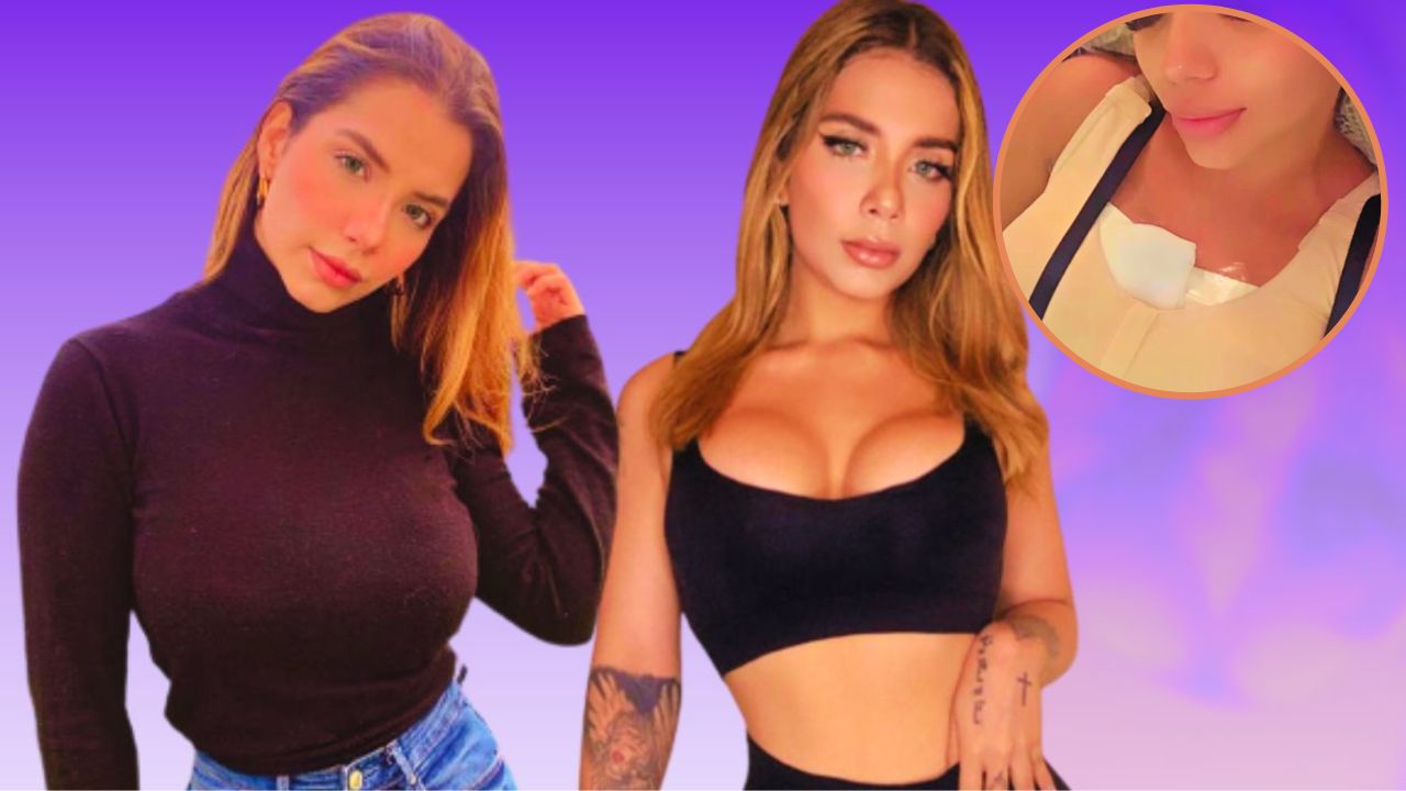 Imagen de Jennifer Fúnes se somete a nueva cirugía estética