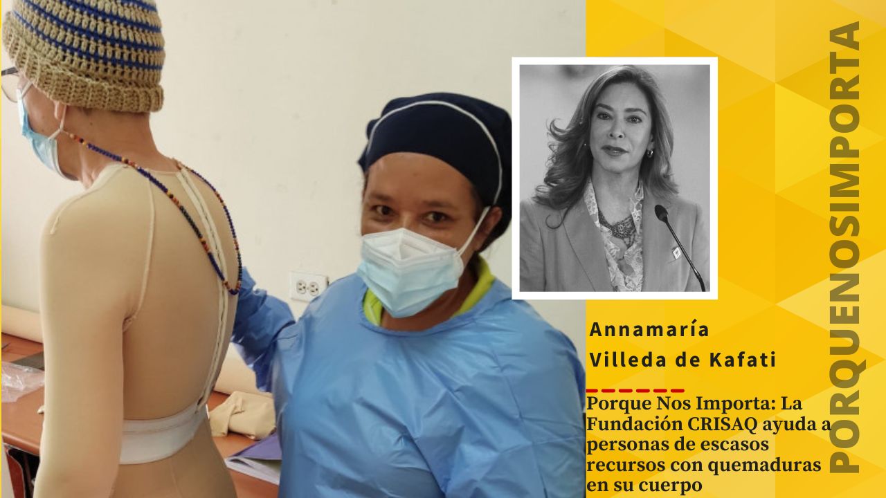 Imagen de Porque Nos Importa: La Fundación CRISAQ ayuda a personas de escasos recursos con quemaduras en su cuerpo