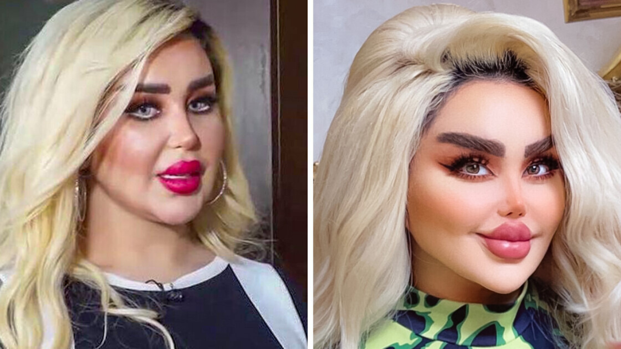 Imagen de ¡Obsesión por ser Barbie! Actriz lleva 43 cirugías para parecer muñeca