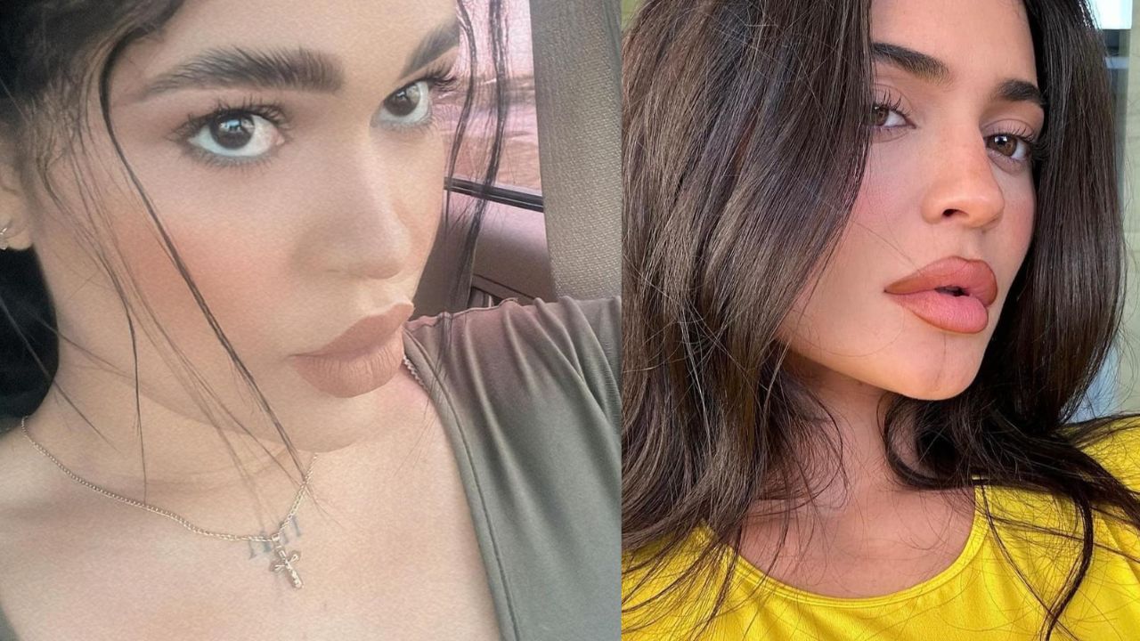 Imagen de 'Juanchi' sorprende con su radical cambio de imagen al lucir idéntica a Kylie Jenner ¿Tiene cirugías?