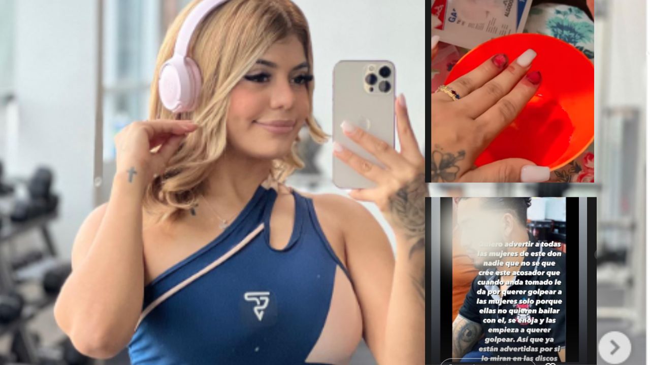 Imagen Principal de Nota: Nicky Escobar, modelo de contenido para adultos denuncia a sampedrano por agresión