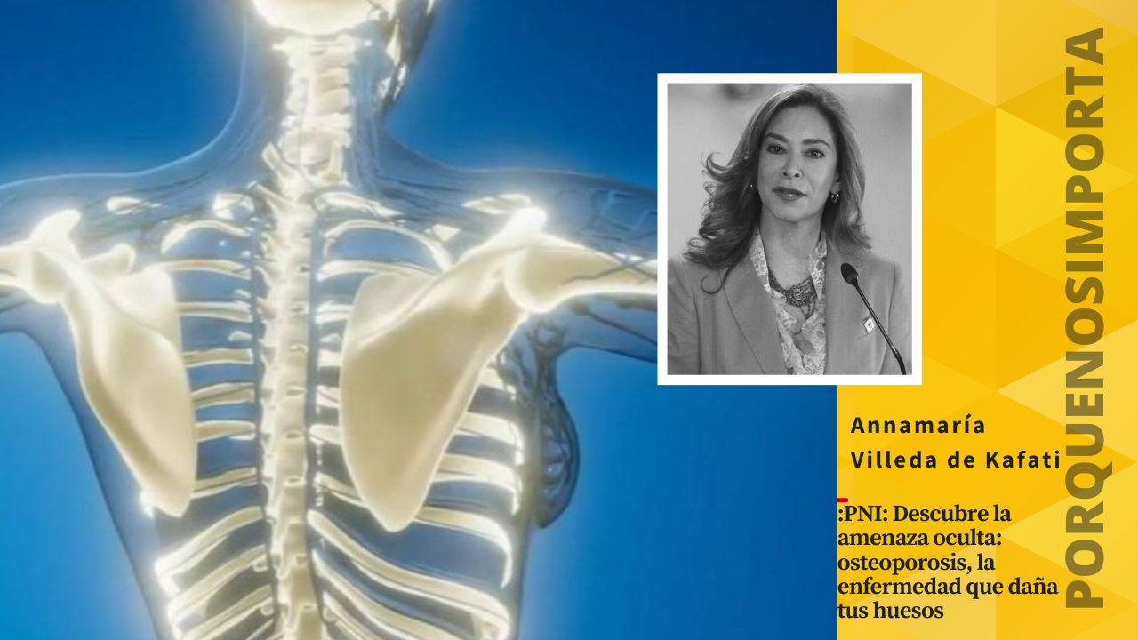 Imagen Principal de Nota: PNI: Descubre la amenaza oculta: osteoporosis, la enfermedad que daña tus huesos