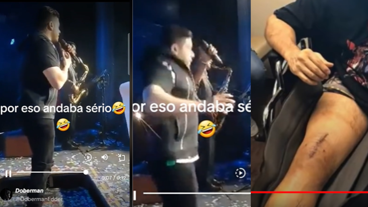 Imagen Principal de Nota: 'Con razón', brutal caída de Jerry Rivera en pleno escenario lo mandó a cirugía ¿En qué momento fue?