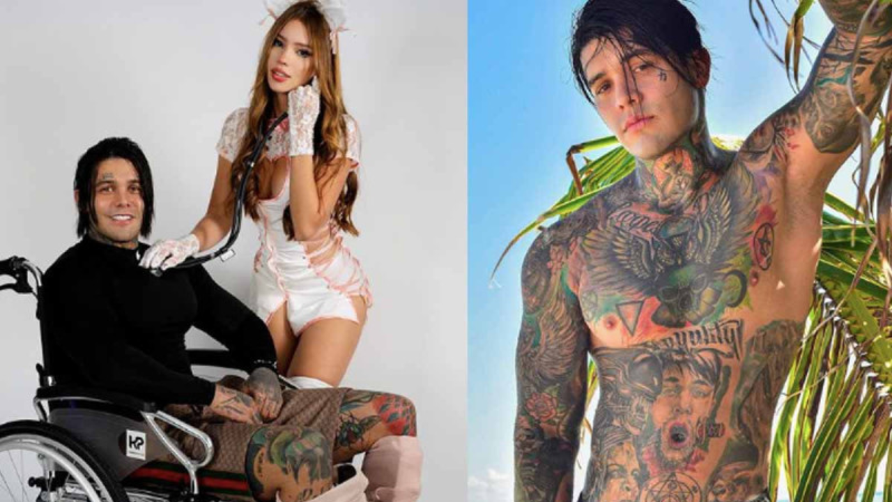 Imagen de Influencer Yeferson Cossio se aumenta la estatura y sufre doloroso resultado