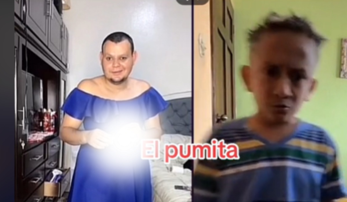 Imagen Principal de Nota: Tiktoker hondureño, Urías Lobo, se prende fuego en un en vivo para recibir regalos