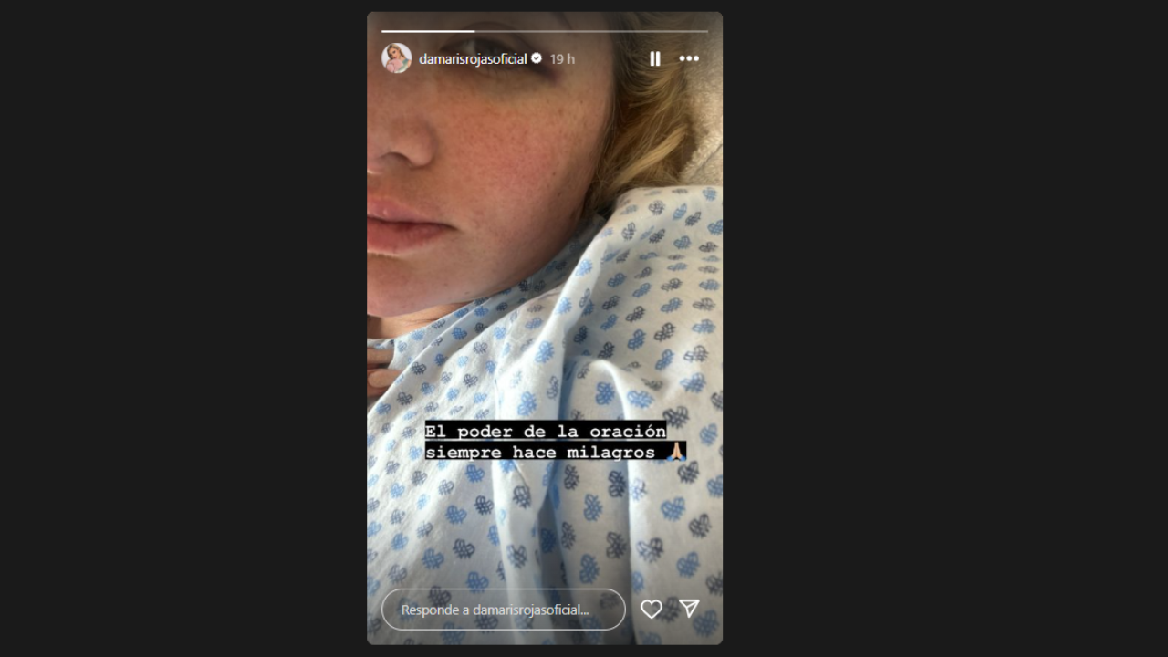 Imagen Principal de Nota: Accidente Damaris Rojas, ¿qué le pasó a la expresentadora del programa 'Hoy' ?