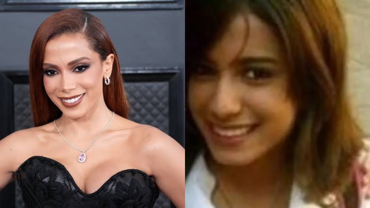 Imagen de Anitta antes y después de cirugías plásticas