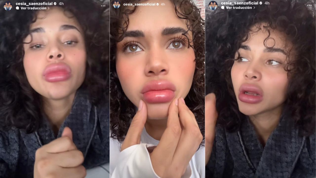 Imagen Principal de Nota: Cesia Sáenz aparece con sus labios inflamados ¿Exceso de bótox?