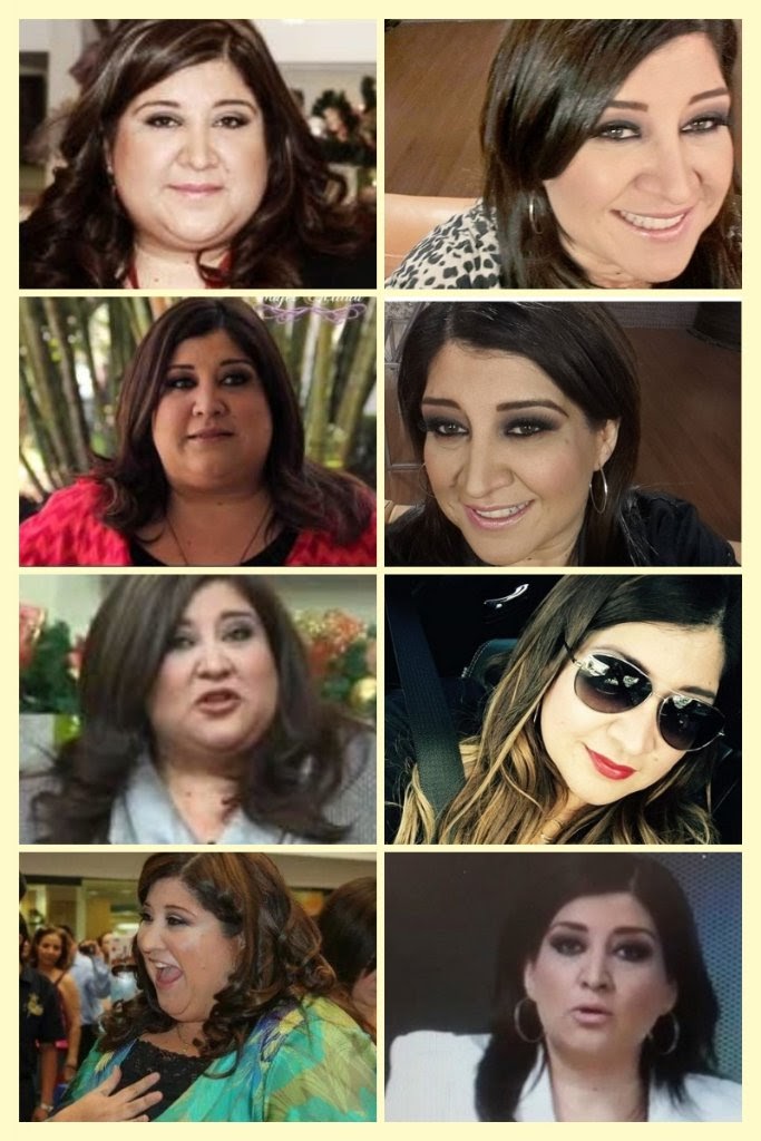 Laura Rivas antes y después