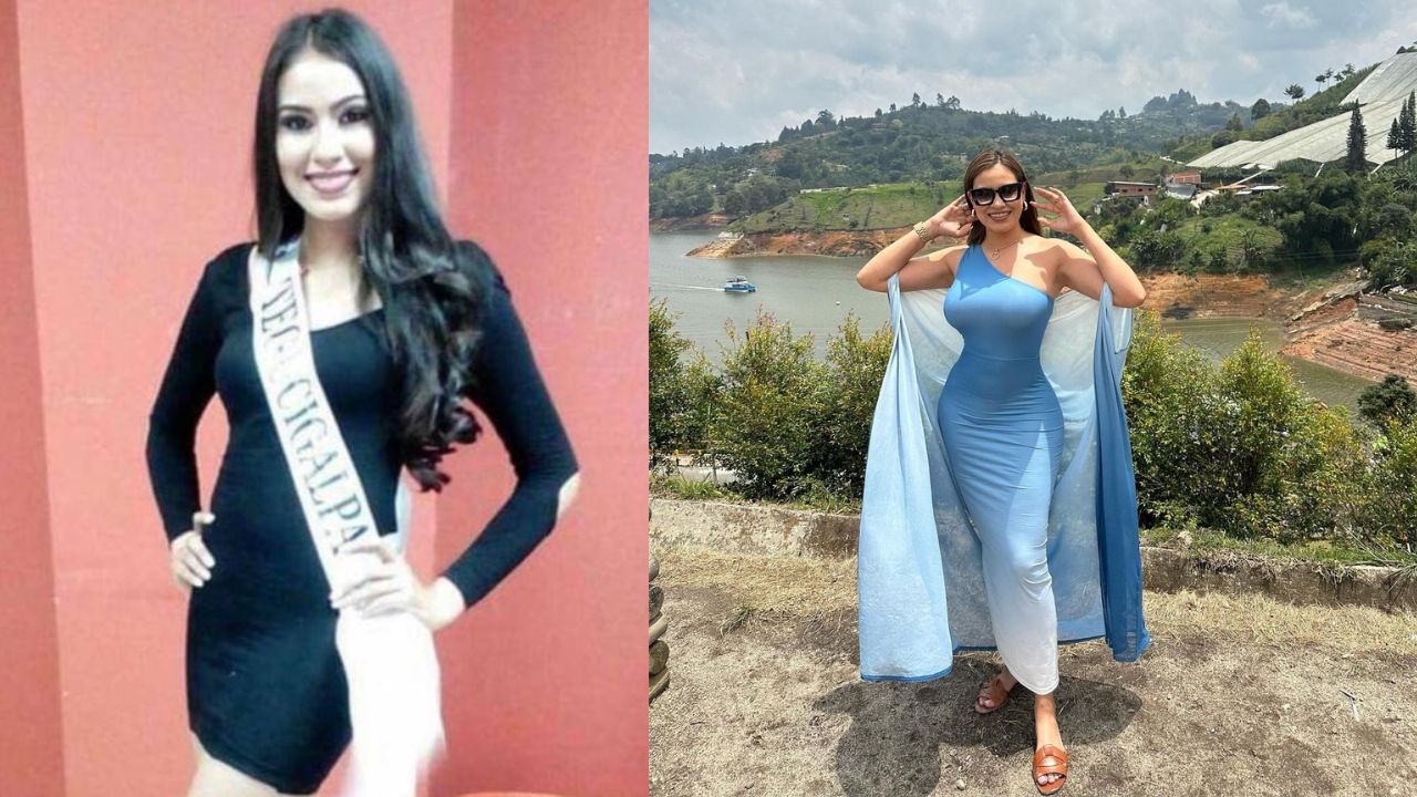 Imagen Principal de Nota: Alejandra Rubio confiesa los motivos que la llevaron a realizarse cirugía