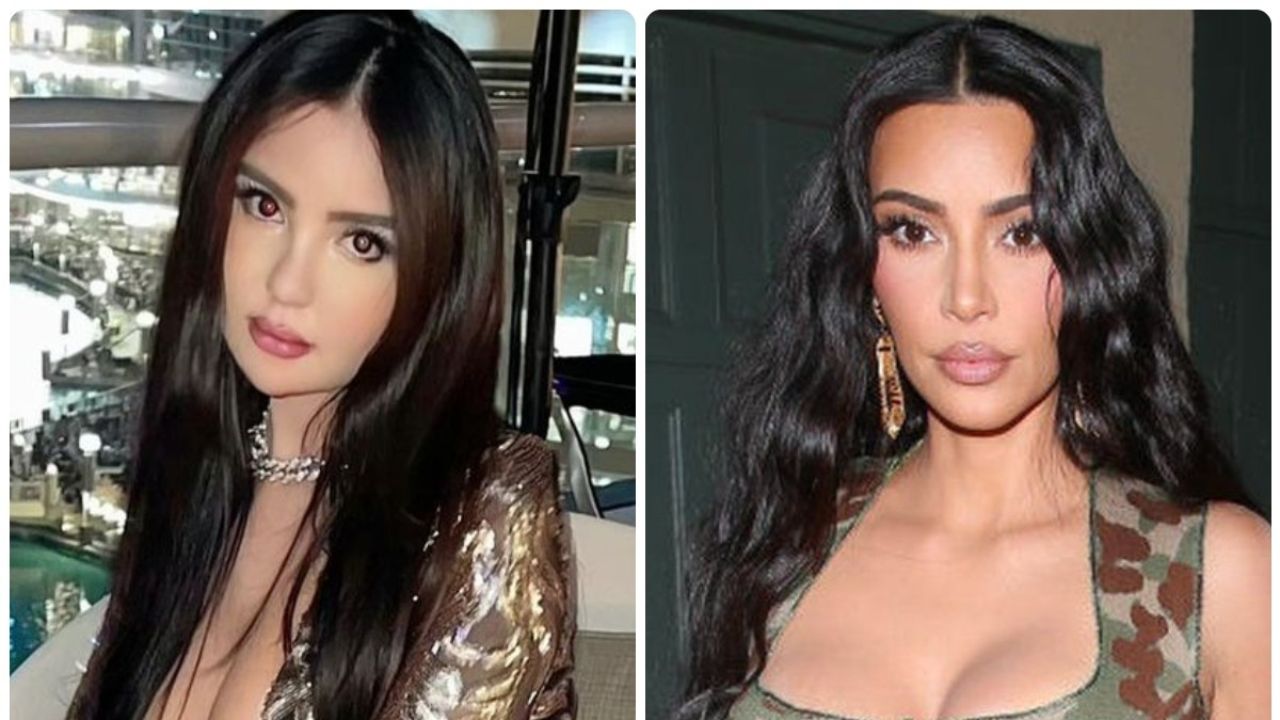 Imagen Principal de Nota: Cirugía de modelo que deseaba ser  Kim Kardashian acaba en tragedia