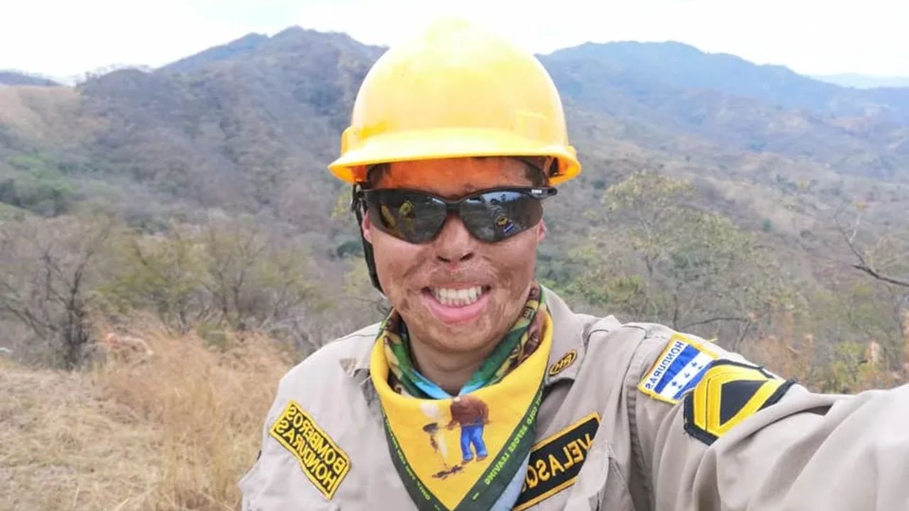 Imagen Principal de Nota: Ever Velásquez confiesa como fue verse por primera vez después del incendio