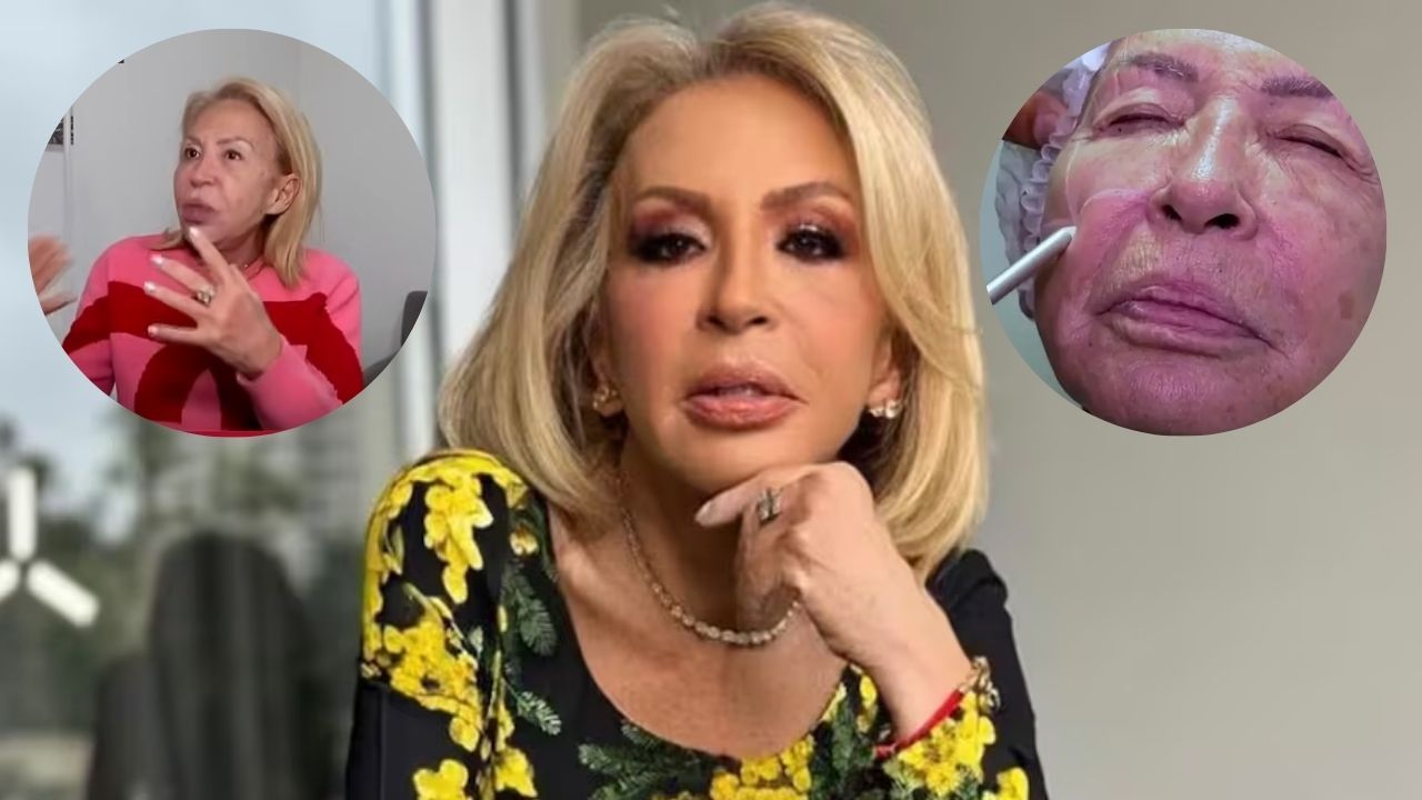 Imagen Principal de Nota: Laura Bozzo revela su transformación  de rostro tras procedimiento estético en Perú