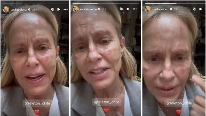 Cecilia Bolocco lesiones