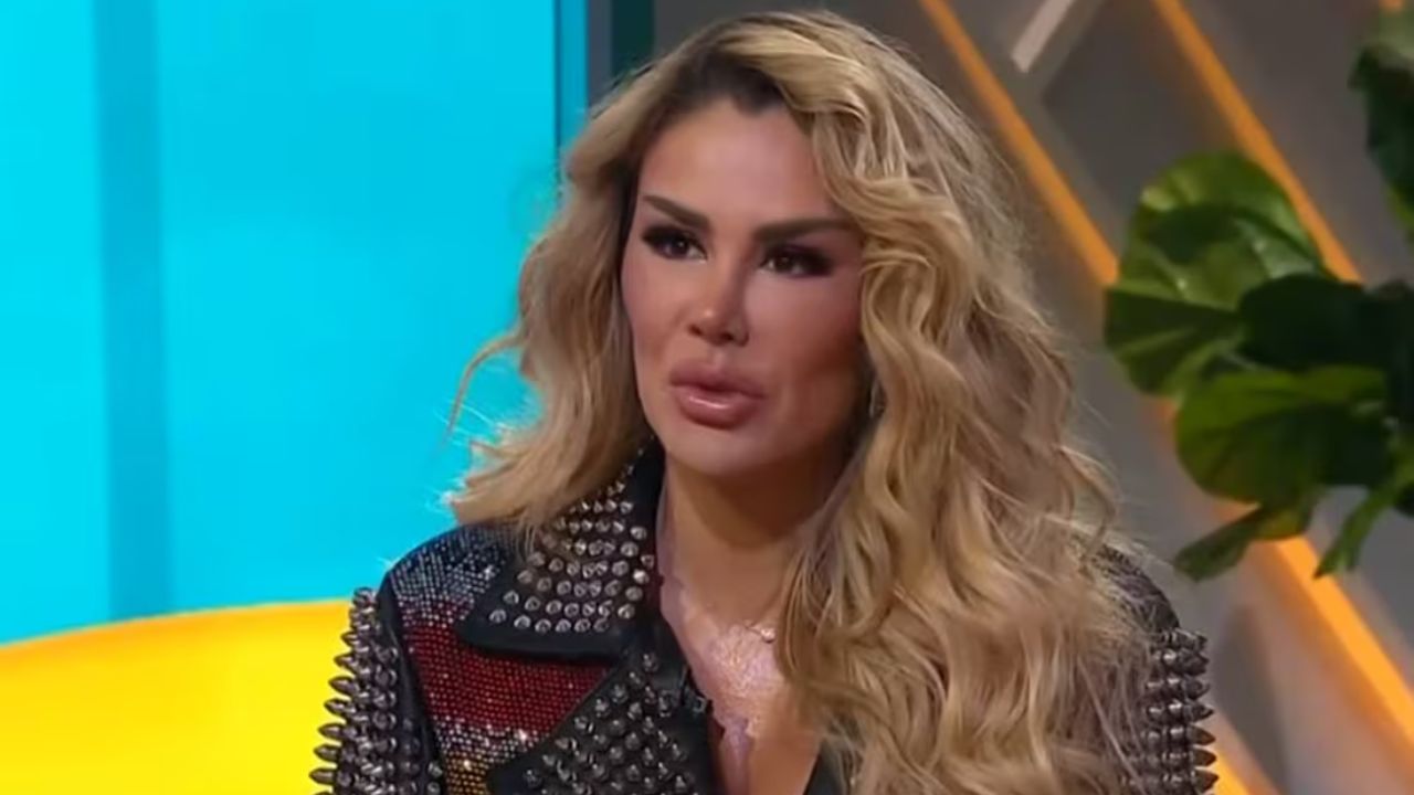 Imagen Principal de Nota: Ninel Conde se someterá a otra cirugía a pesar de las críticas