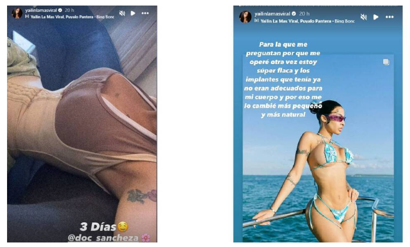 Yailin ex de Tekashi