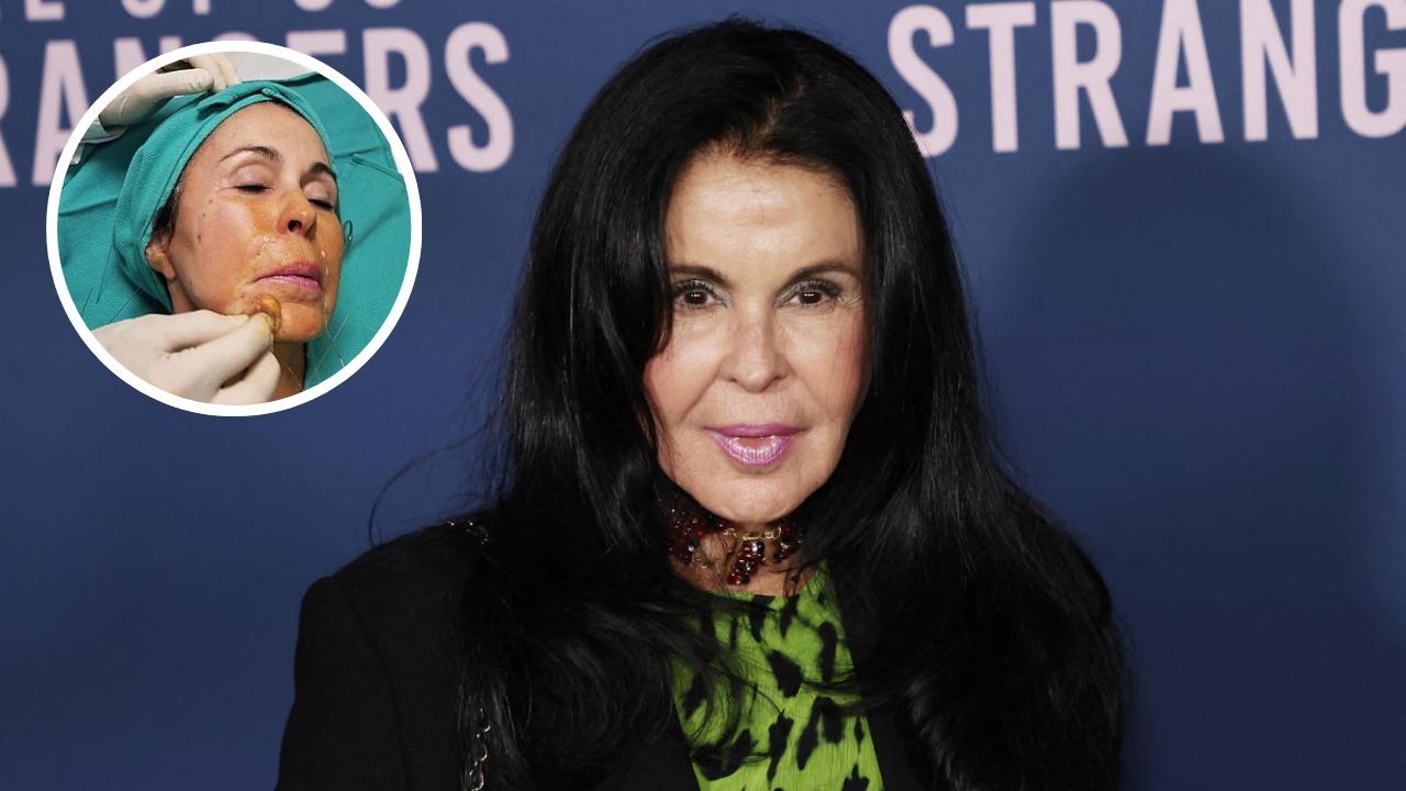 Imagen Principal de Nota: María Conchita Alonso revela los motivos de su reciente cirugía