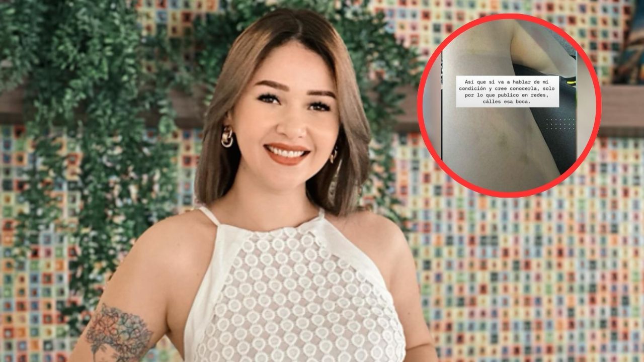 Imagen Principal de Nota: Jennifer Aplícano muestra moretones y responde a las críticas recibidas