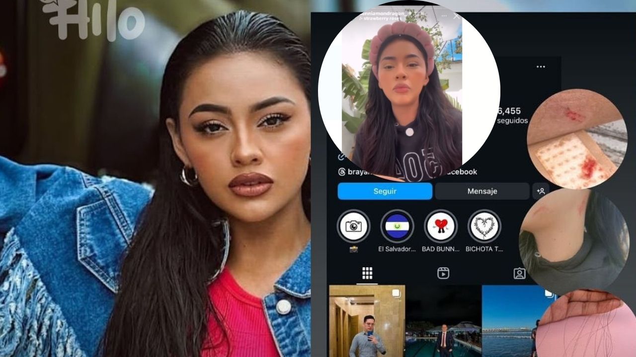 Imagen Principal de Nota: Kennia Mondragón denuncia agresión del mejor amigo de su novio: ‘Él no es gay, le gusto yo’