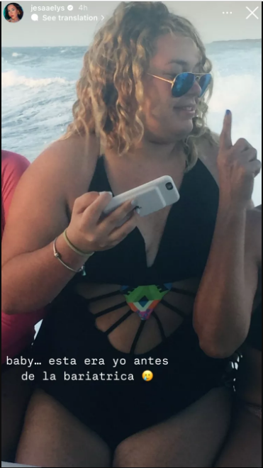 Jesaelys en su lucha con el sobrepeso, su antes de la cirugía