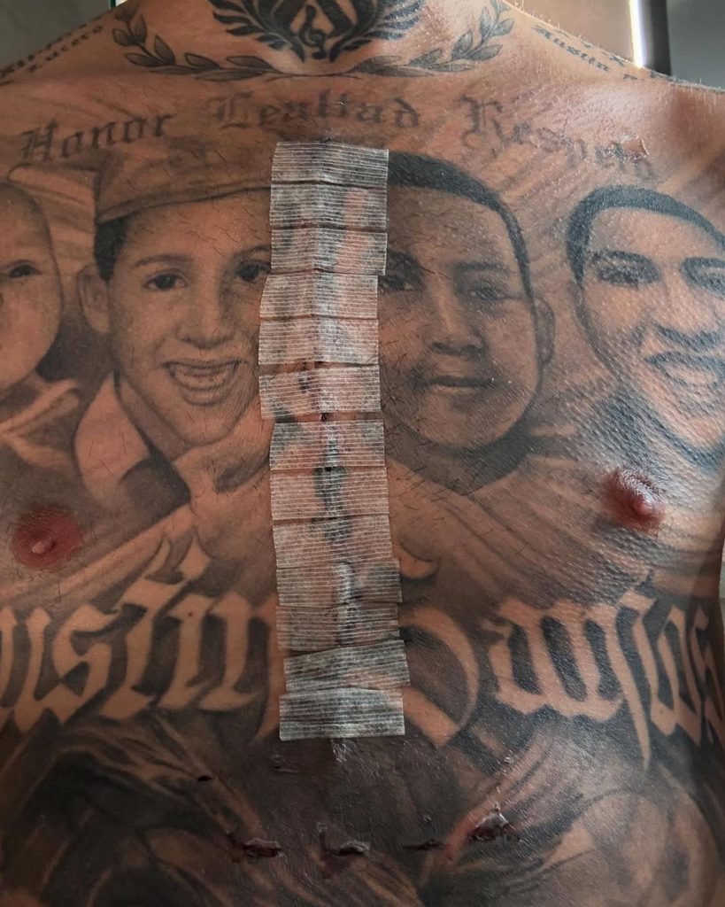 Arcangel cicatriz