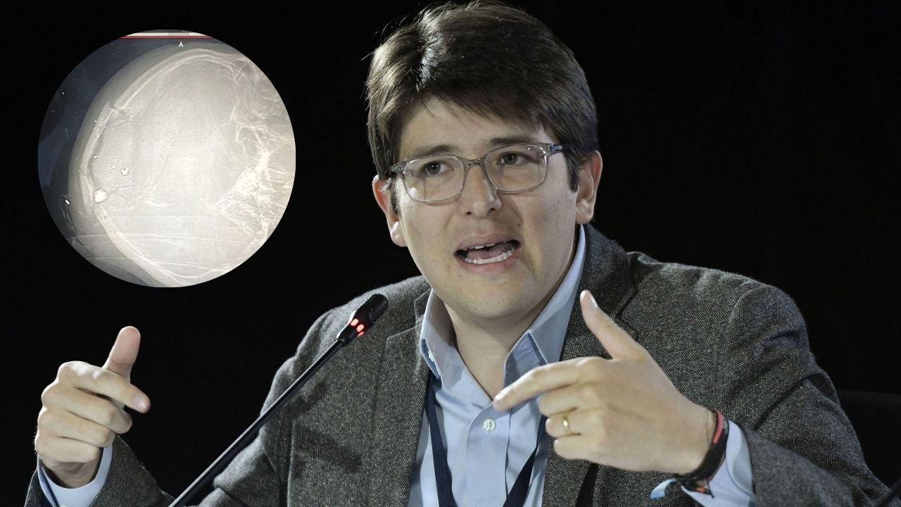 Imagen Principal de Nota: Miguel Uribe Turbay sigue en estado crítico: la bala permanece alojada en su cabeza
