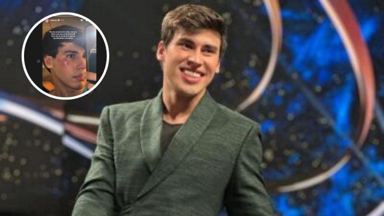 Imagen Principal de Nota: La Divaza muestra heridas en el rostro tras fuerte caída que preocupó a fans