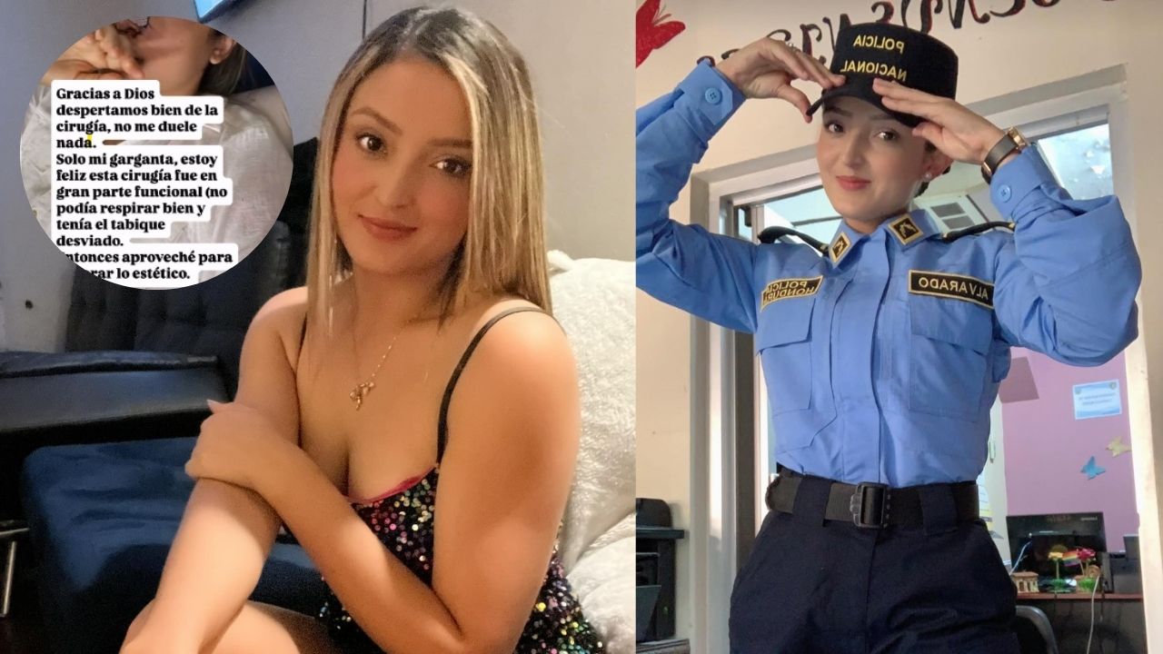 Imagen de 'La Barbie Policía' se opera en EE. UU. y muestra resultados