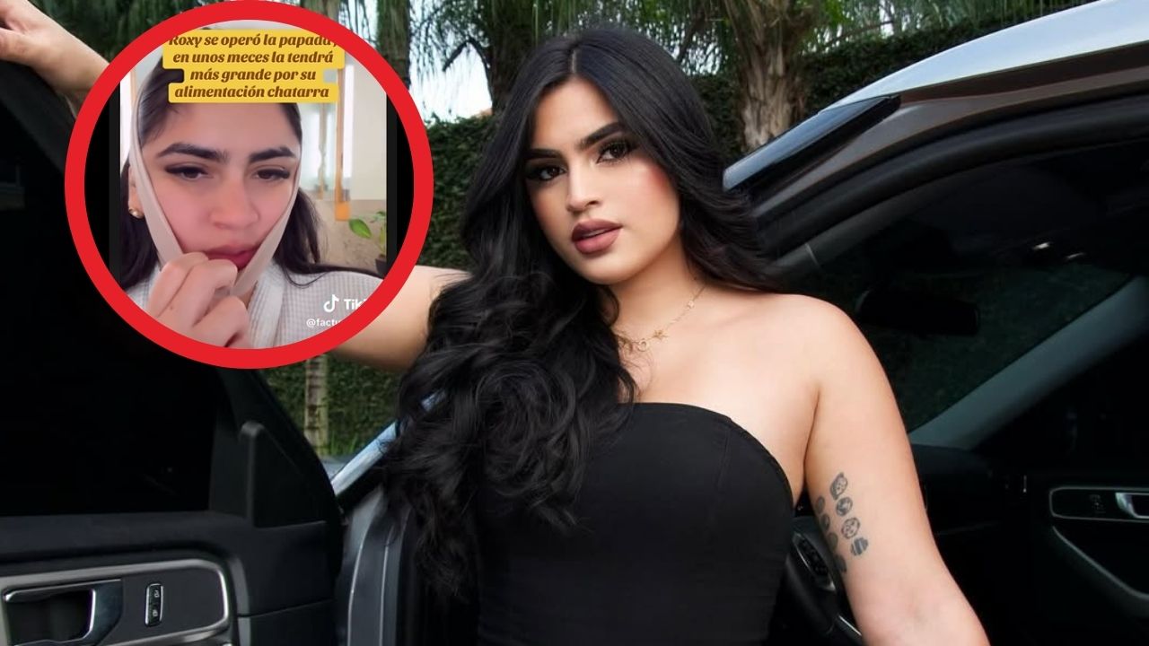 Imagen Principal de Nota: Roxanna Somoza se somete a cirugía de papada y enciende las redes con su nueva imagen