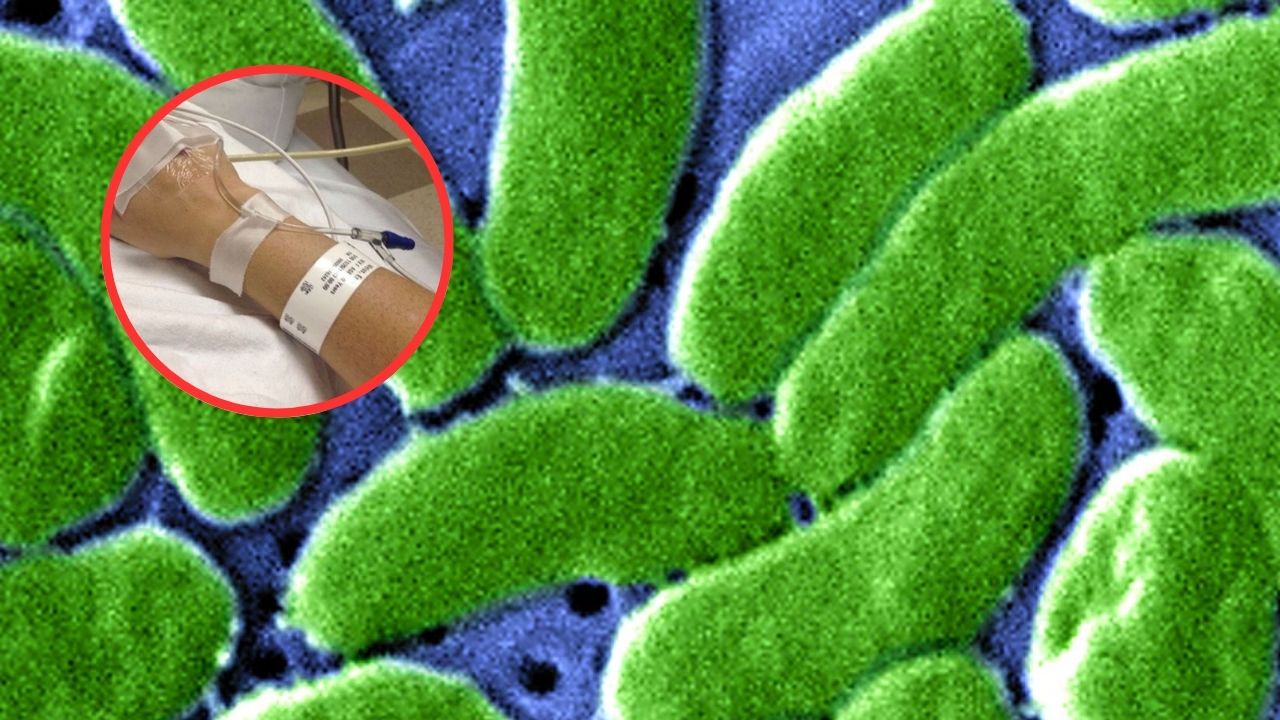 Bacteria come carne reaparece en Florida, ya hay víctimas fatales
