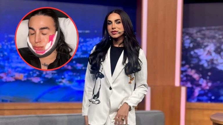 Imagen Principal de Nota: Betanco se somete a cirugía estética y sorprende a fans ¿Qué se hizo?