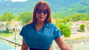 Imagen de ¿Elsa Oseguera se operó la cara? Esta es su nueva cirugía
