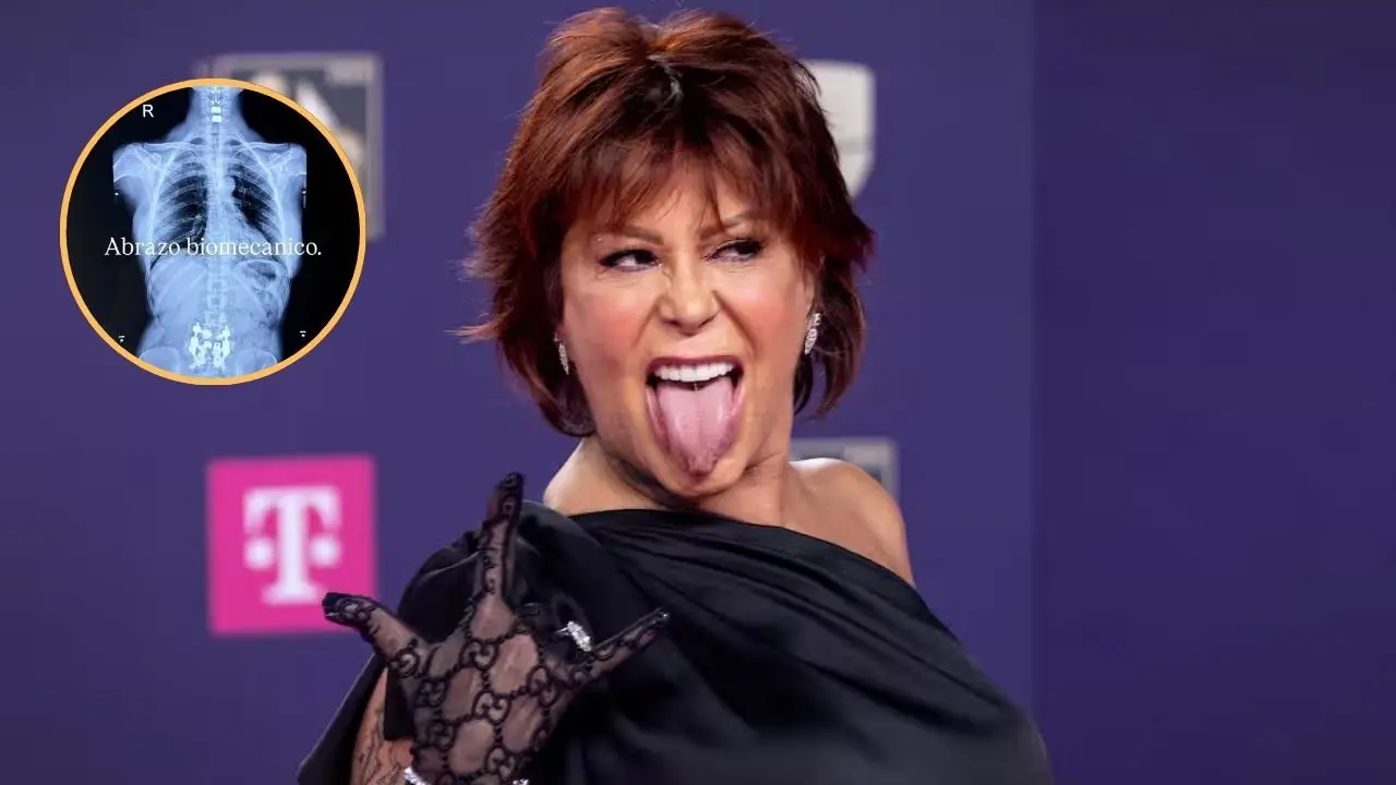 Alejandra Guzmán sorprende a fans con impactante imagen de su cirugía