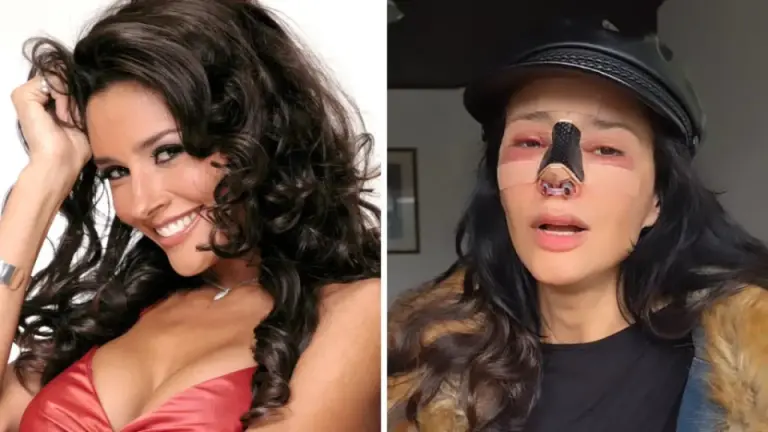 Imagen Principal de Nota: Filtran fotografías de reconocida modelo y actriz con el rostro desfigurado