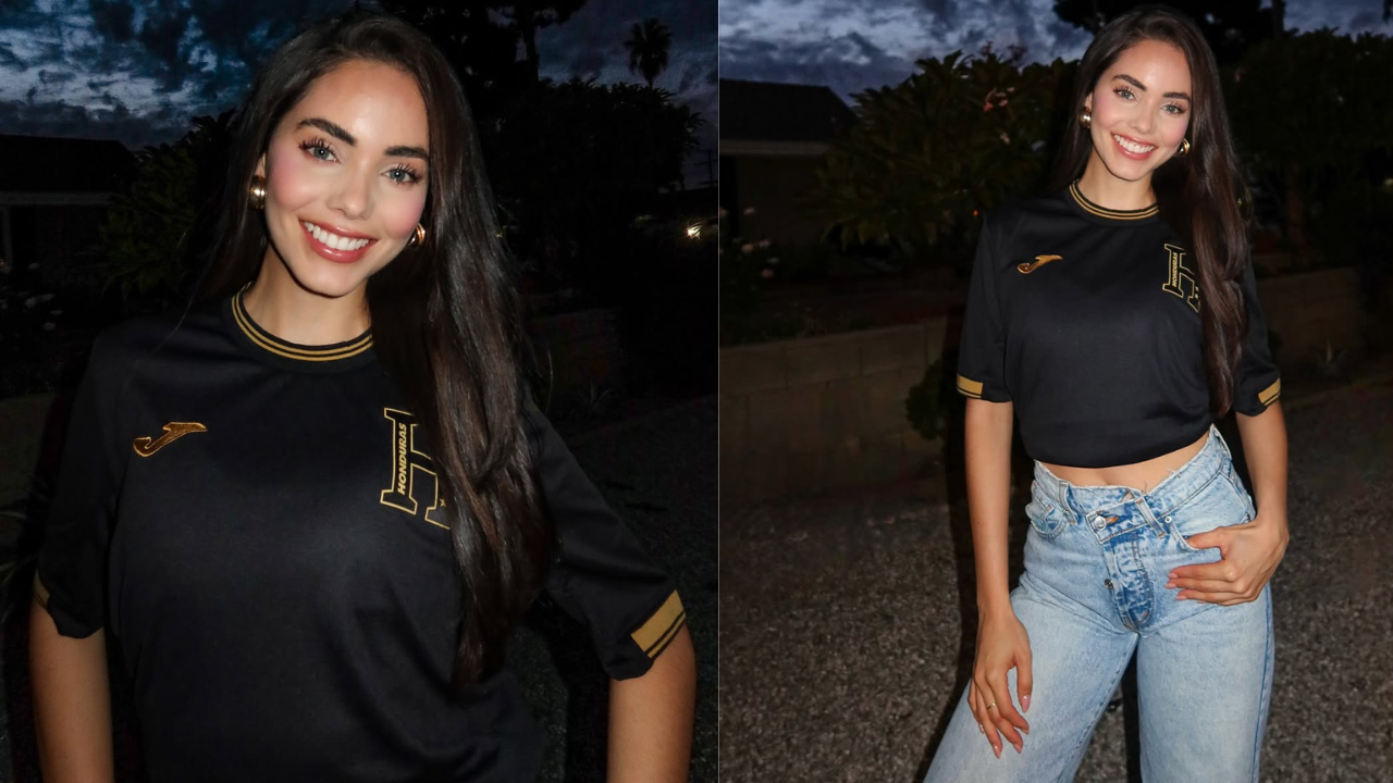 Imagen Principal de Nota: Modelo hondureña confiesa que atraviesa serio problema de salud