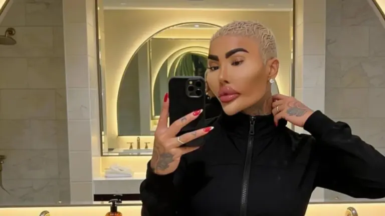 Muere influencer tras someterse a varias cirugías para parecerse a las Kardashian