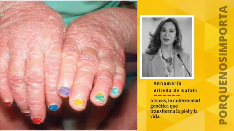 Imagen Principal de Nota: Ictiosis, la enfermedad genética que transforma la piel y la vida