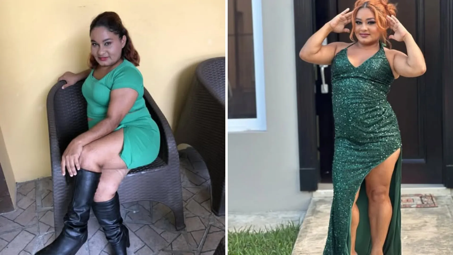 Paty Burgo antes  y despúes